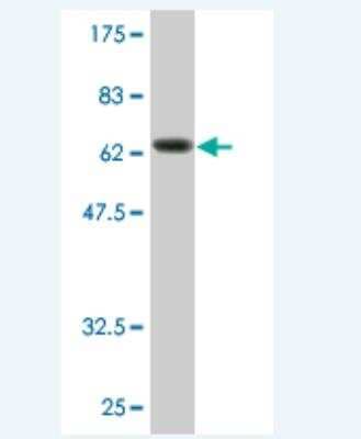 Western Blot: Ago2/eIF2C2 Antibody (4D1-1D1) [H00027161-M02]