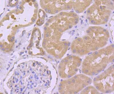 Immunohistochemistry-Paraffin: Ago2/eIF2C2 Antibody (JF0992) [NBP2-67121]