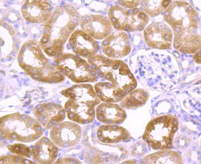 Immunohistochemistry-Paraffin: Ago2/eIF2C2 Antibody (JF0992) [NBP2-67121]