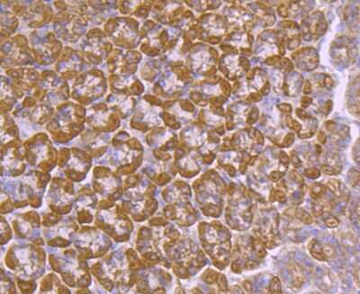 Immunohistochemistry-Paraffin: Ago2/eIF2C2 Antibody (JF0992) [NBP2-67121]