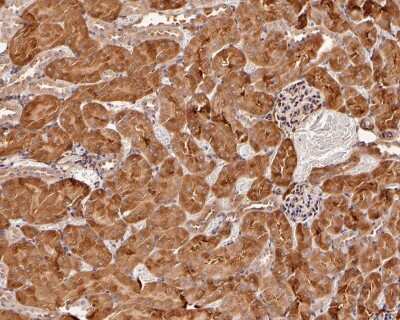 Immunohistochemistry-Paraffin: Ago2/eIF2C2 Antibody (JF0992) [NBP2-67121]