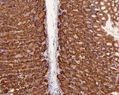 Immunohistochemistry-Paraffin: Ago2/eIF2C2 Antibody (JF0992) [NBP2-67121]