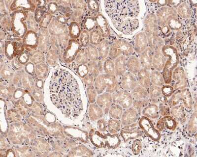 Immunohistochemistry-Paraffin: Ago2/eIF2C2 Antibody (JF0992) [NBP2-67121]