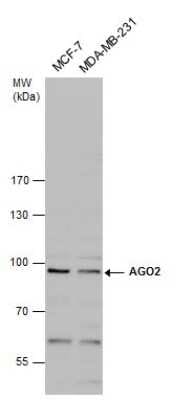 Western Blot: Ago2/eIF2C2 Antibody [NBP3-13024]