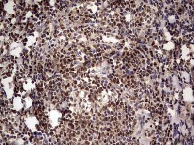 Immunohistochemistry: Aiolos/IKZF3 Antibody (OTI7E11) [NBP2-46048]