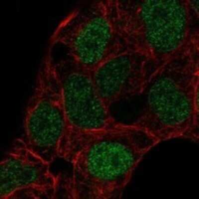 Immunocytochemistry/ Immunofluorescence: Aiolos/IKZF3 Antibody [NBP3-16978]