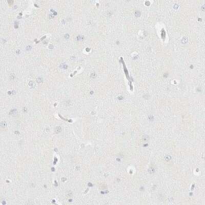 Immunohistochemistry-Paraffin: Aiolos/IKZF3 Antibody [NBP1-89185]
