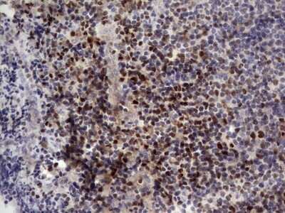 Immunohistochemistry: Aiolos/IKZF3 Antibody (OTI7E11) - Azide and BSA Free [NBP2-71698]
