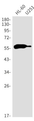 Western Blot: Aiolos/IKZF3 Antibody (S01-0C5) [NBP3-20069]