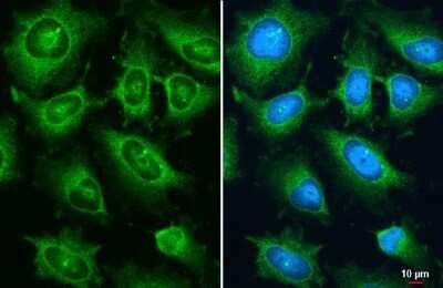 Immunocytochemistry/ Immunofluorescence: Ajuba Antibody [NBP3-13402]