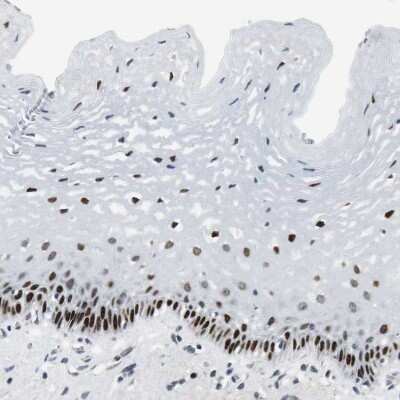 Immunohistochemistry-Paraffin: Ajuba Antibody [NBP1-89570]