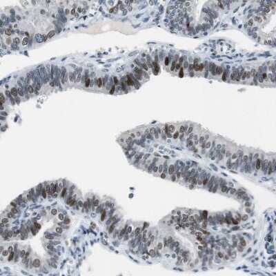 Immunohistochemistry-Paraffin: Ajuba Antibody [NBP1-89570]