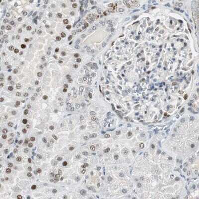 Immunohistochemistry-Paraffin: Ajuba Antibody [NBP1-89570]
