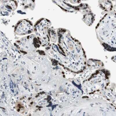 Immunohistochemistry-Paraffin: Ajuba Antibody [NBP1-89570]