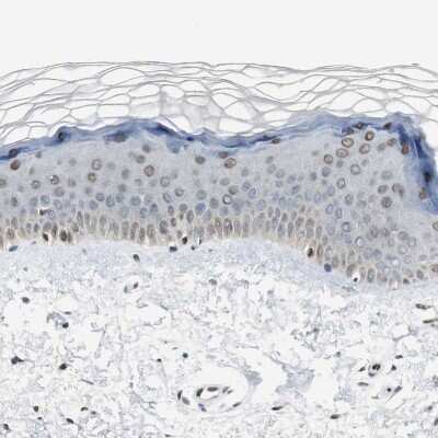 Immunohistochemistry-Paraffin: Ajuba Antibody [NBP1-89570]