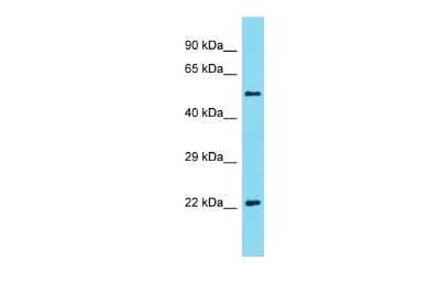Western Blot: Akirin2 Antibody [NBP3-10695]