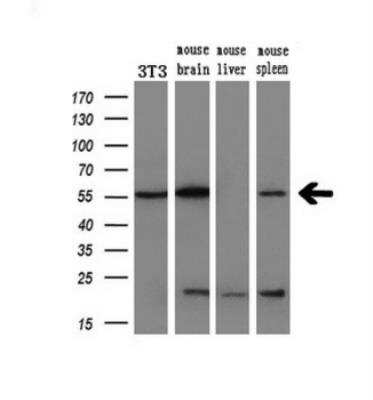 Western Blot: AKT1 Antibody (OTI4D6) [NBP2-01724]