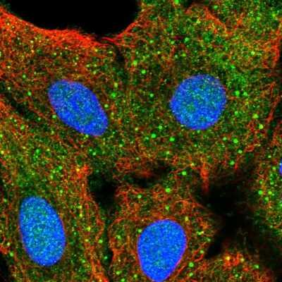 Immunocytochemistry/ Immunofluorescence: AKT2 Antibody [NBP2-55812]