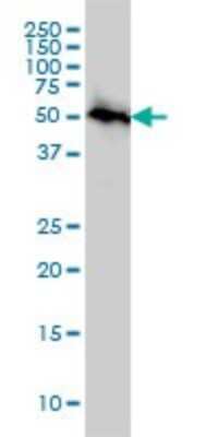 Western Blot: AKT3 Antibody (3F3) [H00010000-M03]