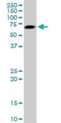 Western Blot: AKT3 Antibody (3F3) [H00010000-M03]