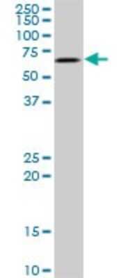Western Blot: AKT3 Antibody (3F3) [H00010000-M03]