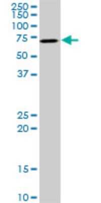 Western Blot: AKT3 Antibody (3F3) [H00010000-M03]