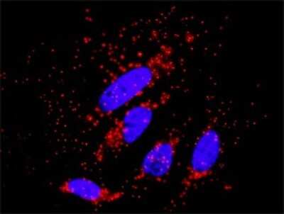 Proximity Ligation Assay: AKT3 Antibody (6E11) [H00010000-M08]