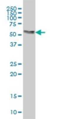 Western Blot: AKT3 Antibody (6E11) [H00010000-M08]