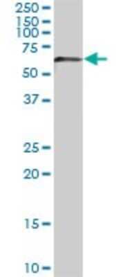 Western Blot: AKT3 Antibody (6E11) [H00010000-M08]