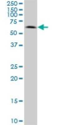 Western Blot: AKT3 Antibody (6E11) [H00010000-M08]