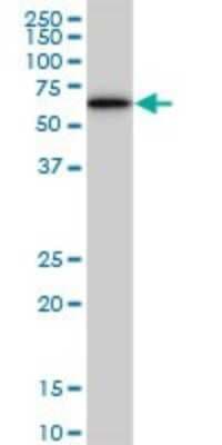 Western Blot: AKT3 Antibody (6E11) [H00010000-M08]