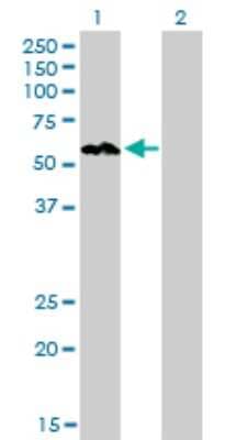 Western Blot: AKT3 Antibody (6E11) [H00010000-M08]