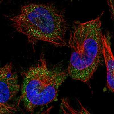 Immunocytochemistry/ Immunofluorescence: Alanyl tRNA synthetase Antibody [NBP2-58166]