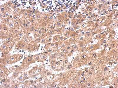 Immunohistochemistry: Alanyl tRNA synthetase Antibody [NBP1-31706]