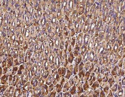 Immunohistochemistry-Paraffin: Alanyl tRNA synthetase Antibody [NBP3-12770]