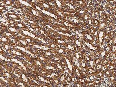 Immunohistochemistry-Paraffin: Alanyl tRNA synthetase Antibody [NBP3-12770]