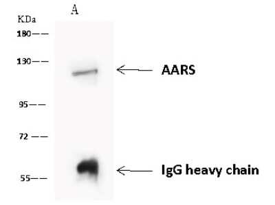 Immunoprecipitation: Alanyl tRNA synthetase Antibody [NBP2-97723]