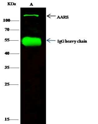 Immunoprecipitation: Alanyl tRNA synthetase Antibody [NBP3-12770]