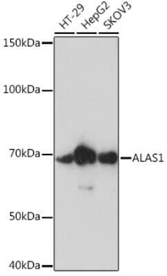 Western Blot: Alas1 Antibody (2K1G3) [NBP3-16487]