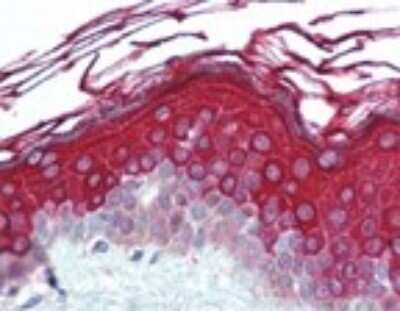 Immunohistochemistry-Paraffin: Alas1 Antibody [NB100-56415]