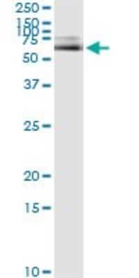 Immunoprecipitation: Albumin Antibody (1G12-1B3) [H00000213-M01]