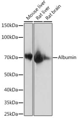 Western Blot: Albumin Antibody (3O4L7) [NBP3-15415]