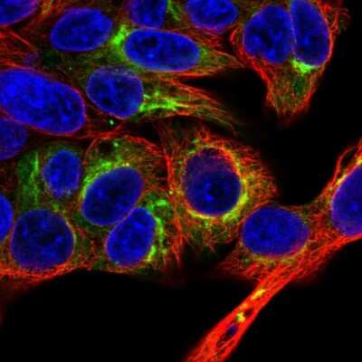Immunocytochemistry/ Immunofluorescence: Albumin Antibody [NBP2-38175]