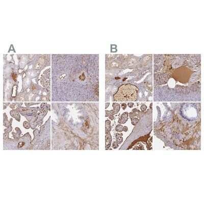Immunohistochemistry-Paraffin: Albumin Antibody [NBP2-38175]