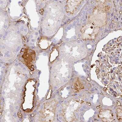 Immunohistochemistry-Paraffin: Albumin Antibody [NBP2-38175]