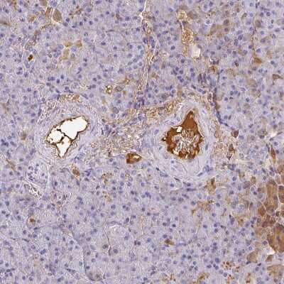Immunohistochemistry-Paraffin: Albumin Antibody [NBP2-38175]