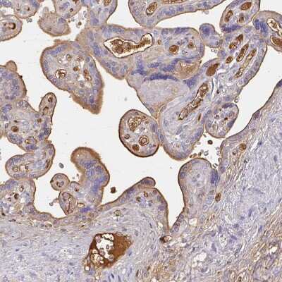 Immunohistochemistry-Paraffin: Albumin Antibody [NBP2-38175]