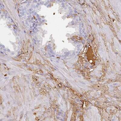 Immunohistochemistry-Paraffin: Albumin Antibody [NBP2-38175]