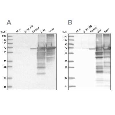 Western Blot: Albumin Antibody [NBP2-38174]