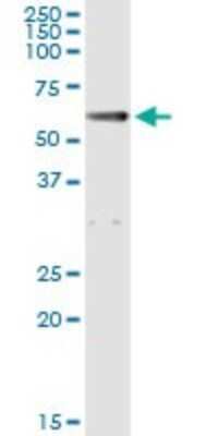 Immunoprecipitation: Aldehyde Dehydrogenase 1-A1/ALDH1A1 Antibody (1G6) [H00000216-M05]